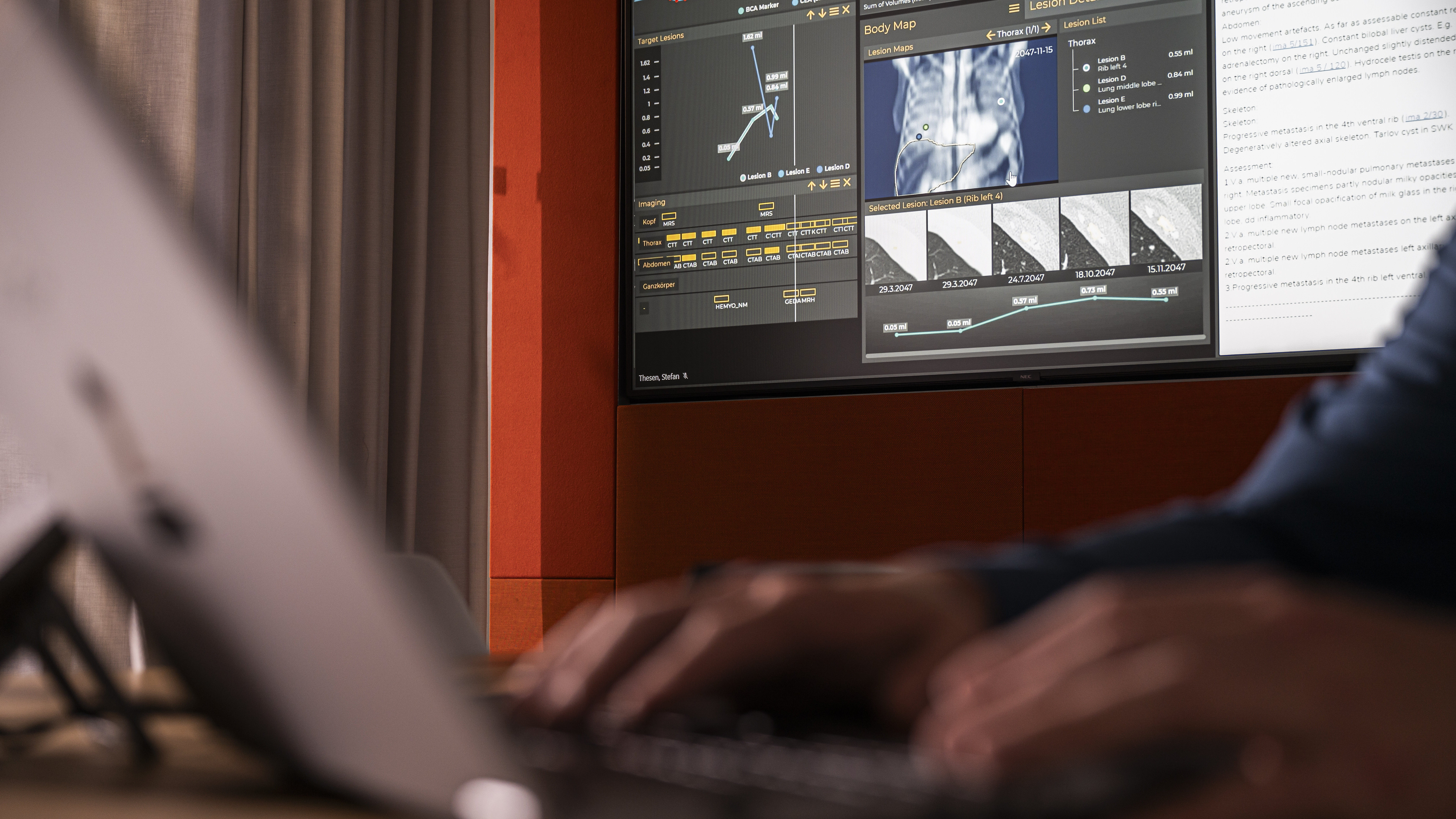 Foto: Im Vordergrund sieht man verschwommen einen aufgeklappten Computer und zwei Hände die auf der Tastatur schrieben. Im Hintergrund, aber auch im Fokus, sieht man ein Bildschirm auf dem ein KI Programm der Medizin zu sehen ist.